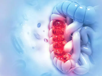 स्वास्थ्य सुझावः धनीलाई लाग्ने रोग अब सबैलाई लाग्न सक्छ