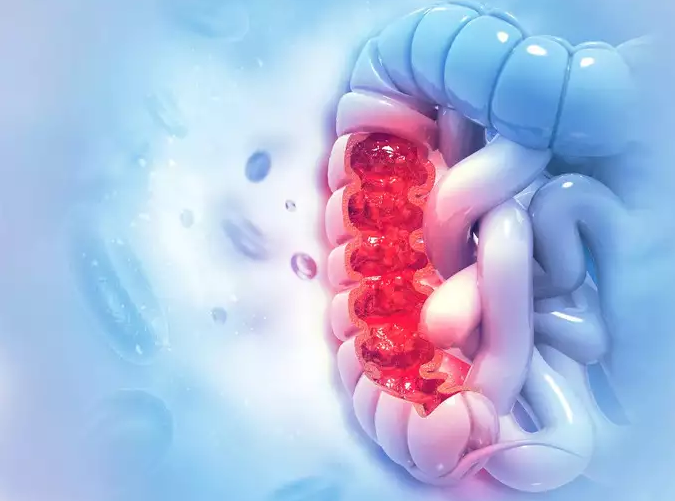 स्वास्थ्य सुझावः धनीलाई लाग्ने रोग अब सबैलाई लाग्न सक्छ